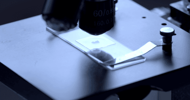 현미경으로 관찰되는 샘플 슬라이드