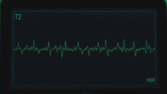 Stable green pulse displayed on heart rate monitor