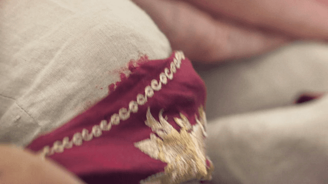 천으로 상처를 감싸는 모습