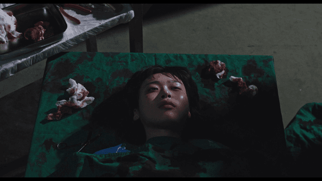 수술대에 누워 있는 여성