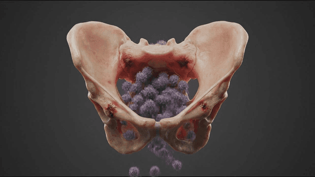 Pelvis containing viral particles