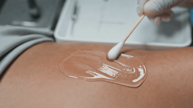 People who apply gel with cotton swabs