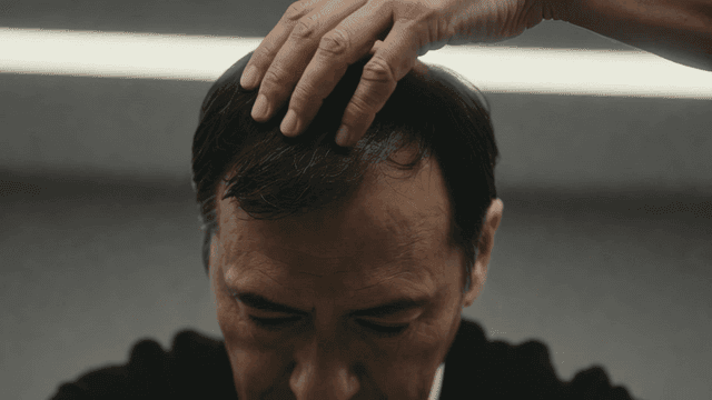 Middle-aged man touching crown of his head due to hair loss