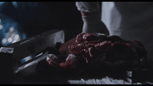 어두운 수술실에서 장기를 내려놓는 외과의사