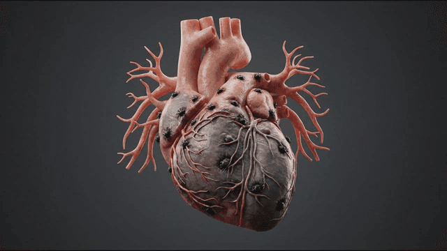 Human heart where infection spreads