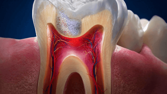 Detailed view of a tooth's internal structure