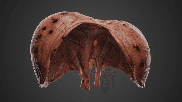 Diaphragm turning black and diseased