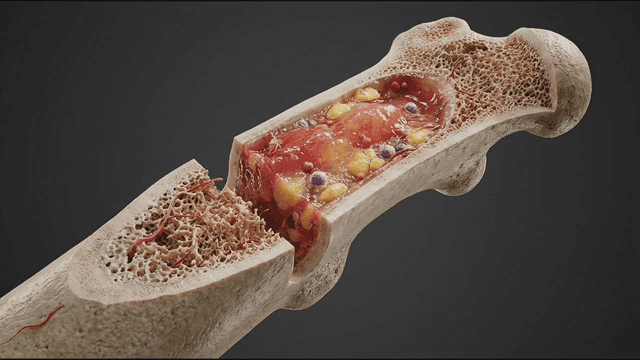 Bone marrow structure and blood cell appearance