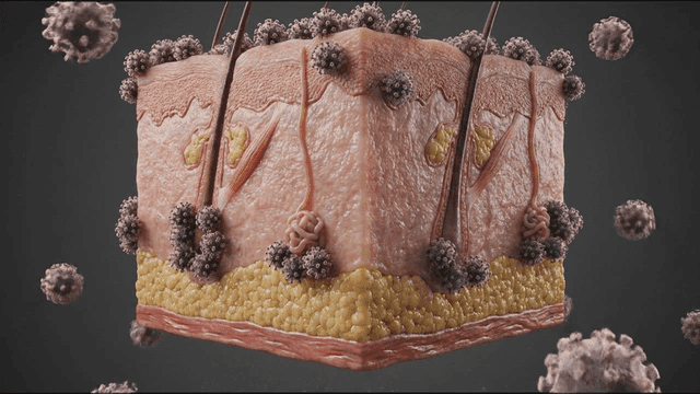 Detailed view of skin layer where virus has spread