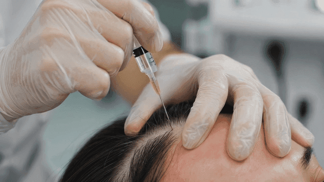 Scalp injection procedure in a clinic