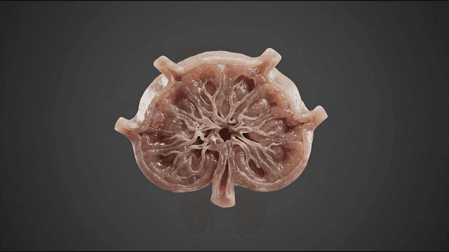 Cross-section of human kidney