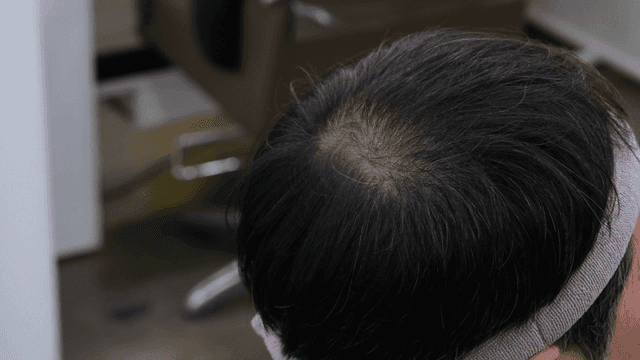 Middle-aged man's head at beauty salon receiving hair care