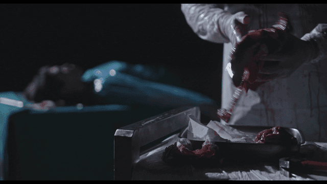 어두운 수술실에서 장기를 만지는 외과의사