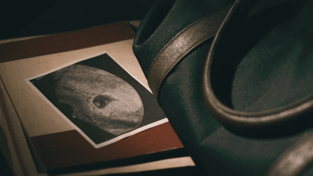 Ultrasound picture next to handbag