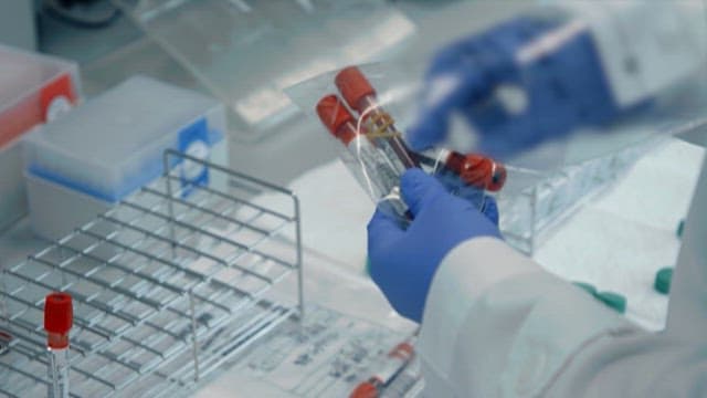 Laboratory Technician Handling Blood Samples
