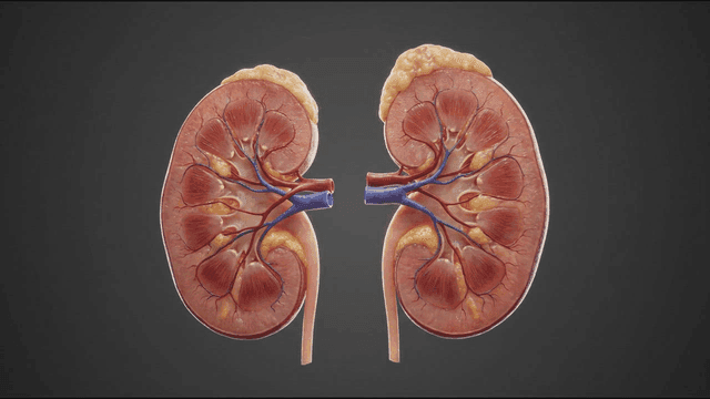 Detailed view of diseased human kidney