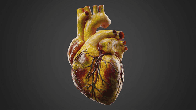 Detailed view of human heart model turning yellow
