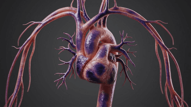 Detailed view of model of diseased human heart aorta