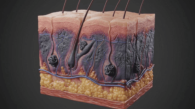 Detailed view of diseased skin layers and structure