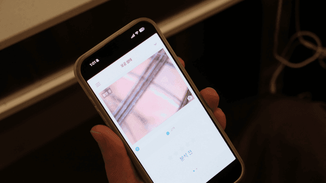 Detailed scalp condition displayed on smartphone