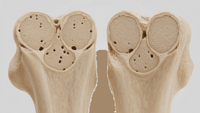 Detailed view of a bone cross-section
