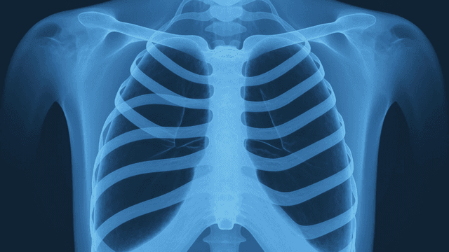 X-ray image of a human chest