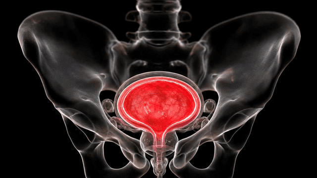 Bladder highlighted in red