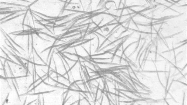 현미경으로 본 미생물의 움직임