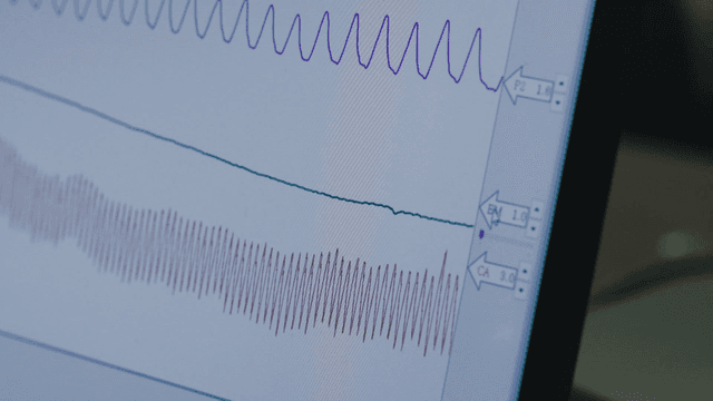 Medical monitor displaying vital signs