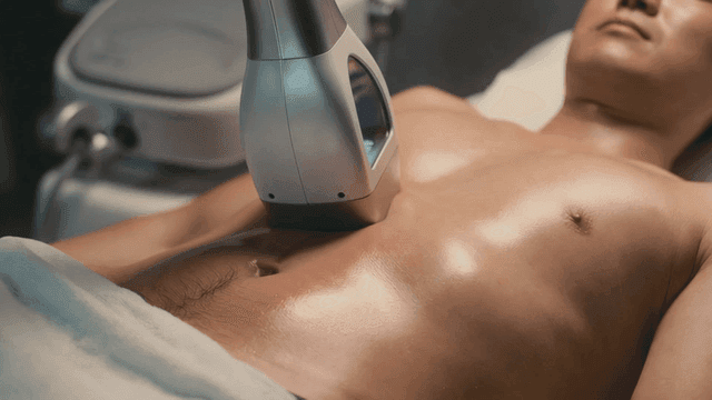 Medical device for cosmetic procedures on man's abdomen