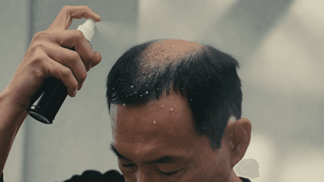 Man spraying hairspray on his bald spots