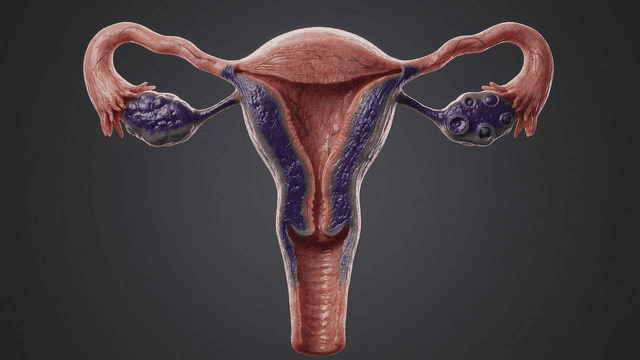 Detailed view of infected human uterus