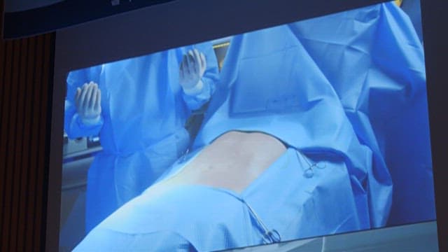Camera Showing Medical Team Preparing for Surgery