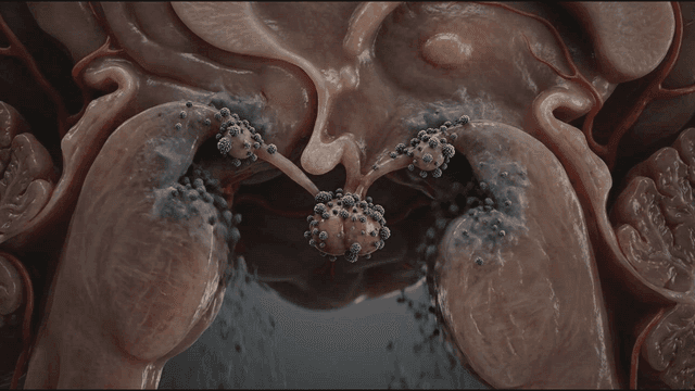 Detailed view of brain rotting from virus