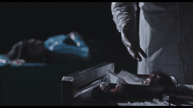 어두운 수술실에서 장기를 내려놓는 외과의사