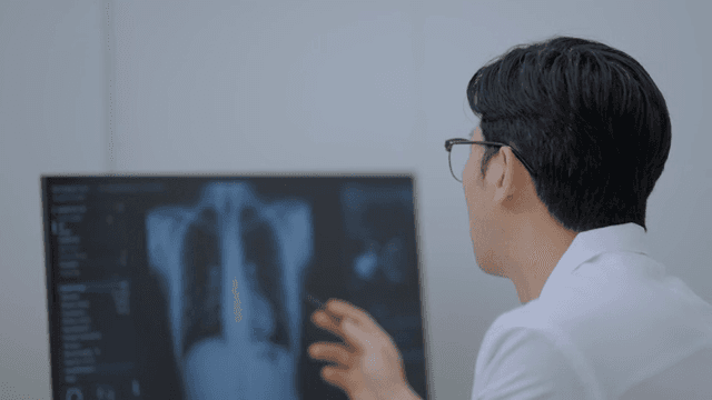 의사가 흉부 X-ray 이미지를 검사하는 모습