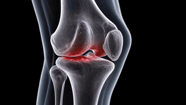 Detailed view of human knee joint emphasized