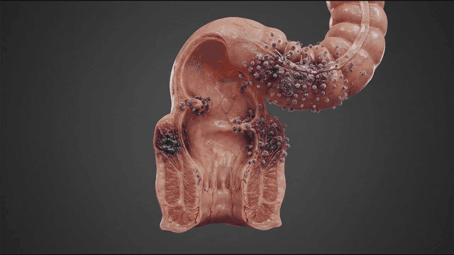 Detailed view of digestive system infected by virus