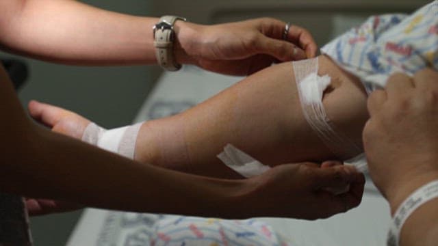 병원에서 환자의 팔을 치료하는 장면