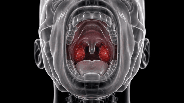 Detailed view of anatomy of palatine tonsils and throat