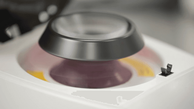 샘플이 있는 원심분리기 작동 중