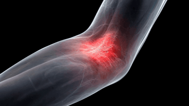 Inflamed skin with glowing redness