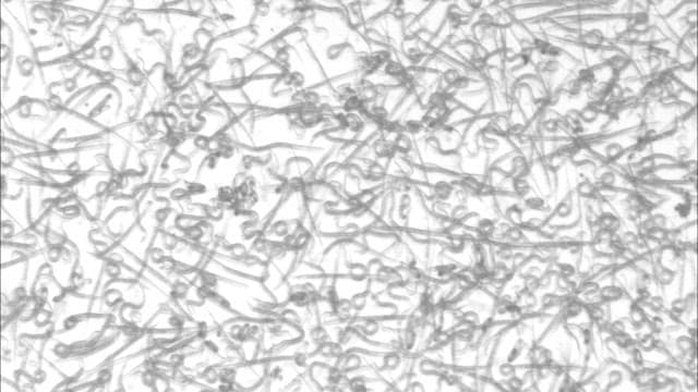 현미경으로 본 미생물의 움직임