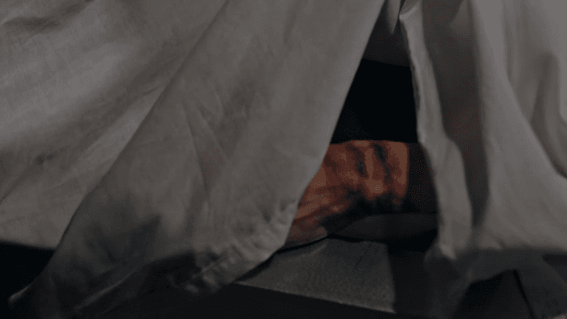 천 아래 깊은 상처가 난 손