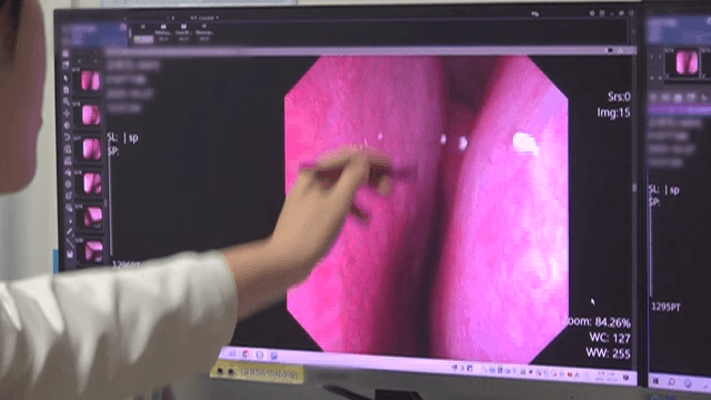 Doctor's hand explaining while looking at rhinitis patient's screen.