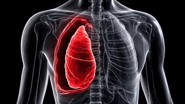 X-ray image of contracted lung