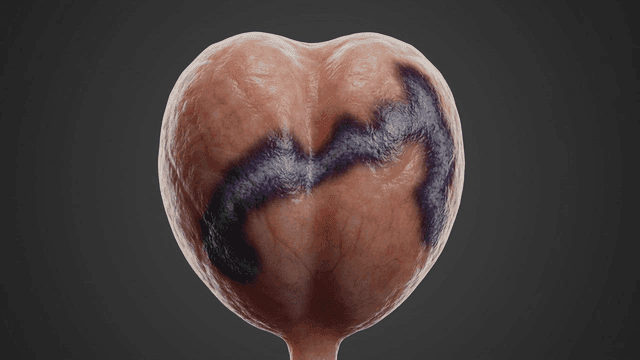 Detailed view of a human organ with discoloration