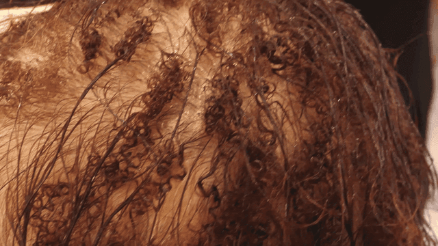 Curly hair for woman with hair loss managed at beauty salon