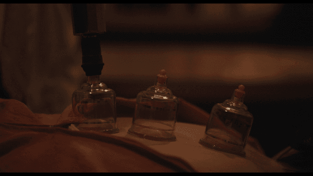 어두운 방에서의 부항 치료 과정