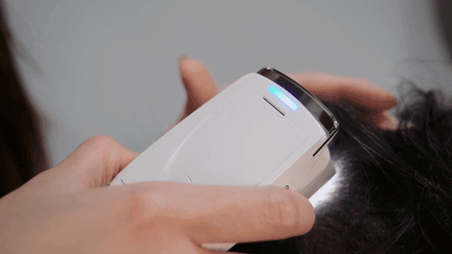 Device examining scalp closely